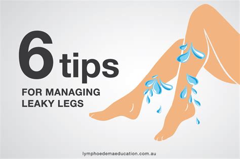 7 Tips For Managing Leaky Legs 